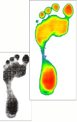 Simple Colour Plantar Pressure System