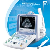 Digital Ultrasound Scanner