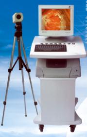 Digital Electron Colposcope Work Station