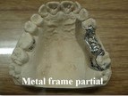 metal framework