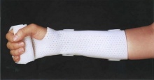 Low Temperature Thermoplastic Splint