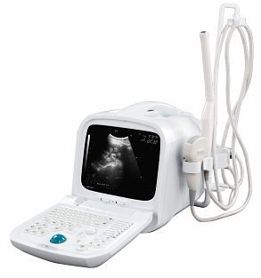 portable ultrasound scanner