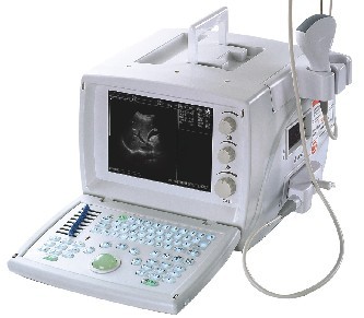 Full Digital Ultrasound Scanner